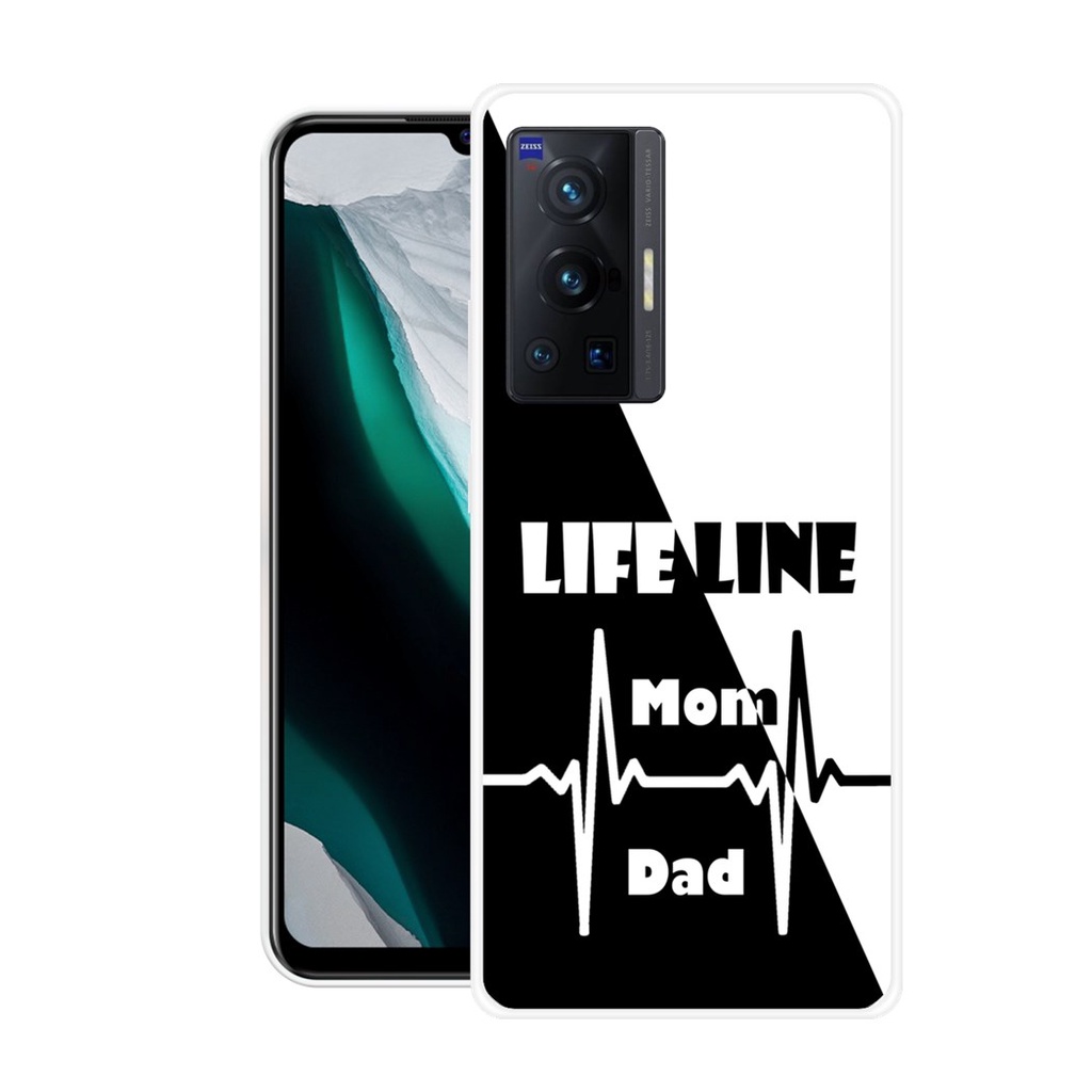 Vivo X70 Pro Mobile back covew by RAJPRINT Shopee India